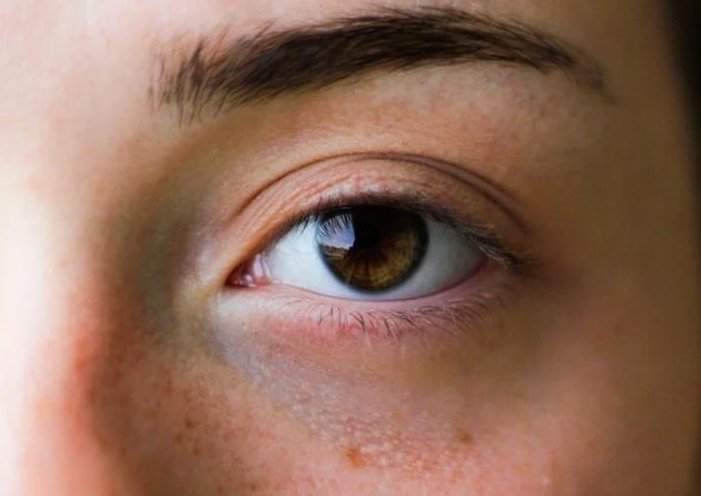 4 dấu hiệu qua đôi mắt cảnh báo bệnh ung thư