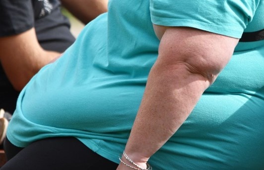 Béo phì bắt nguồn từ não bộ Béo phì bắt nguồn từ não bộ