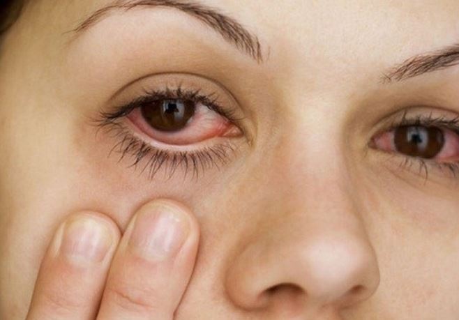 5 triệu chứng về mắt có thể tiết lộ các vấn đề sức khỏe tiềm ẩn