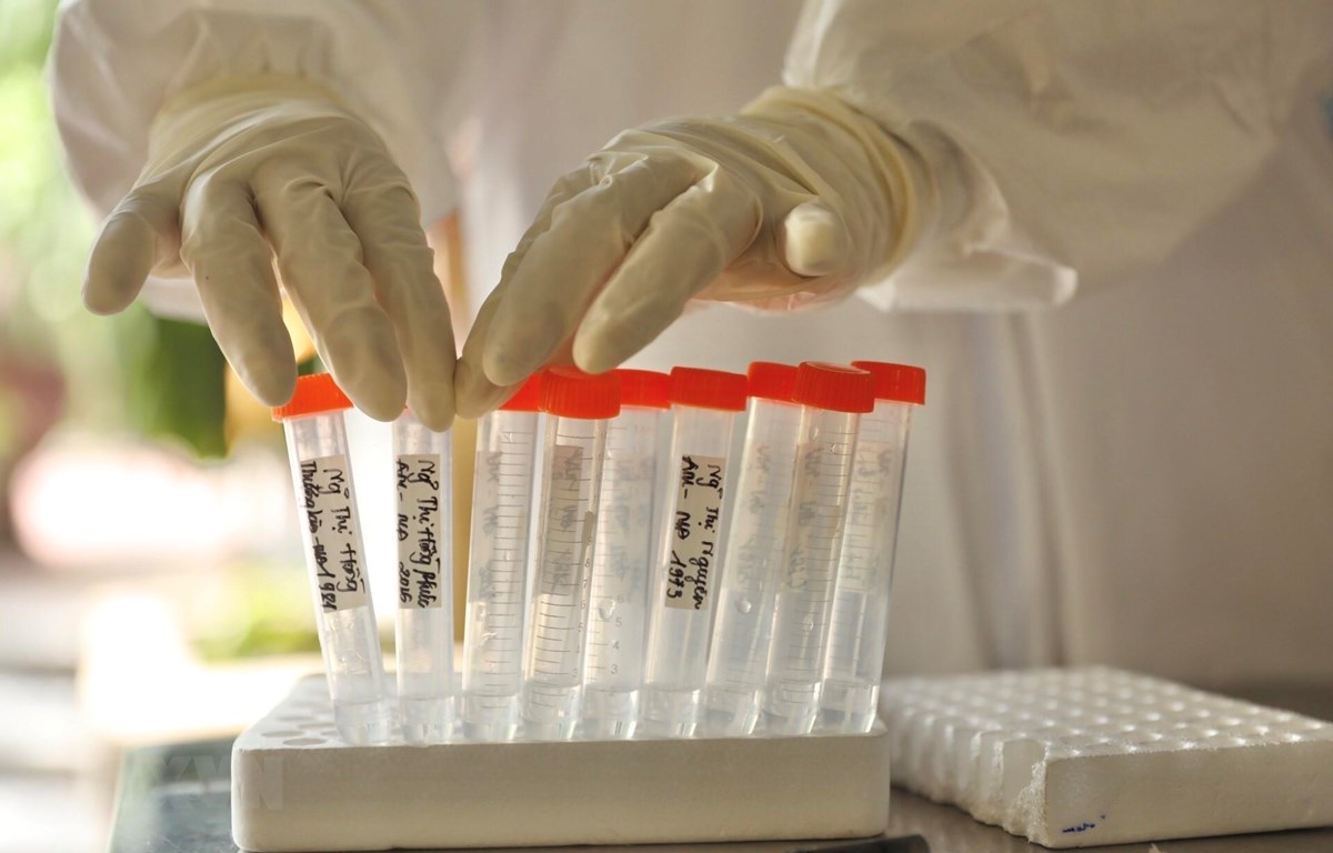 trua 97 ghi nhan them 609 ca mac covid 19 rieng tphcm co 479 ca