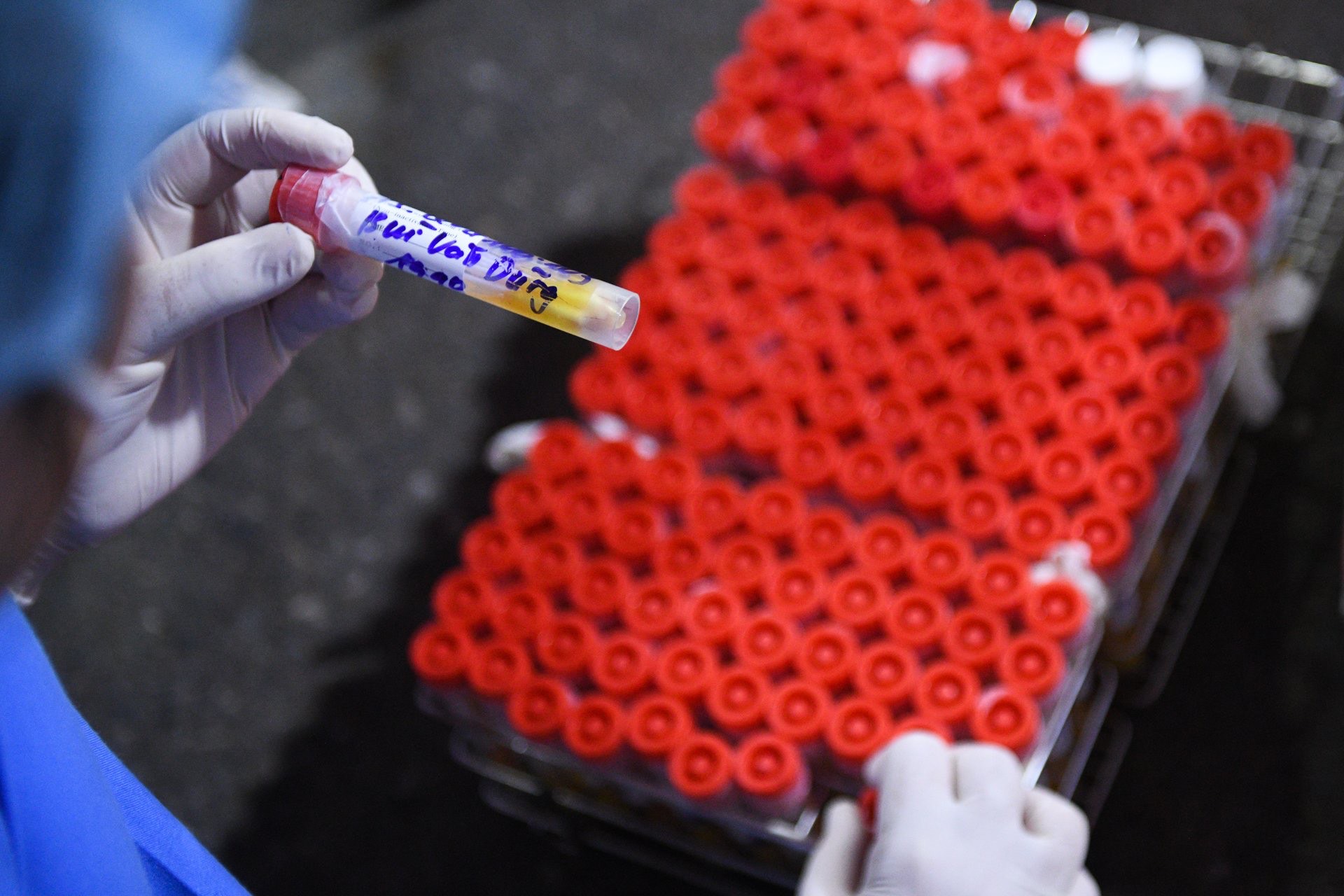 quy dinh moi ve gia dich vu xet nghiem sars cov 2