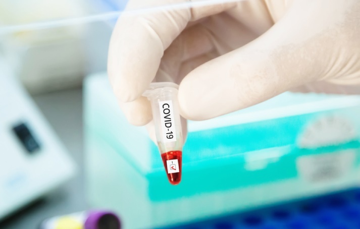 Dịch Covid-19: Phép thử trên con đường phát triển